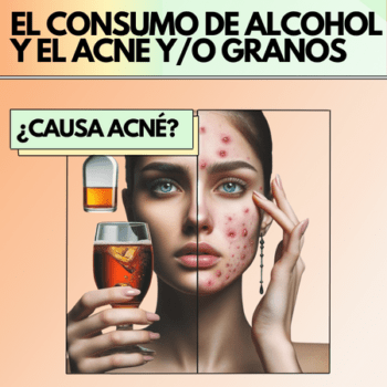 ¿Beber alcohol causa la aparición de acné y/o granos?