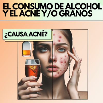 Mitos en cosmética | ¿Beber alcohol causa la aparición de acné y/o granos?
