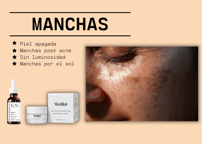 productos para manchas