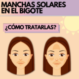 Manchas solares en el Bigote | ¿Cómo eliminar y quitar estas manchas?